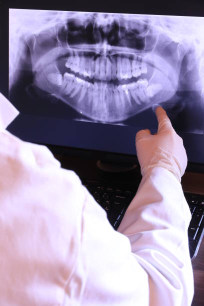 Best Emergency Gum Treatment in Isla Vista, CA